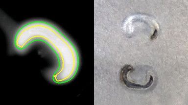 Laser seam with image evaluation algorithm Laser remote welding in car body construction
